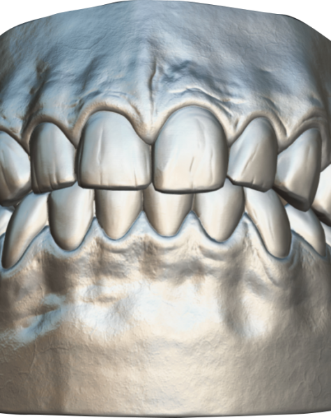 teeth.svg-image896-4294966907